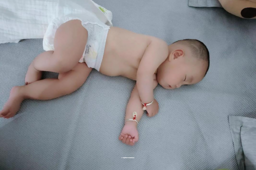 樟树六个月宝宝眼睛散光